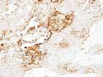 LGR4 Antibody in Immunohistochemistry (Paraffin) (IHC (P))