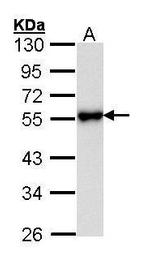 KISS1R Antibody in Western Blot (WB)
