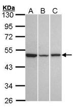 KISS1R Polyclonal Antibody