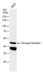 Glucagon Receptor Antibody in Western Blot (WB)