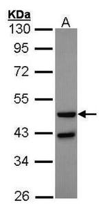 Glucagon Receptor Antibody in Western Blot (WB)