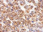 CXCR1 Antibody in Immunohistochemistry (Paraffin) (IHC (P))