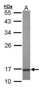 UBE2A Antibody in Western Blot (WB)