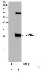 p27 Kip1 Antibody in Immunoprecipitation (IP)