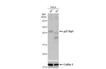 p27 Kip1 Antibody in Western Blot (WB)