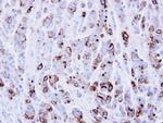 ICAM-1 Antibody in Immunohistochemistry (Paraffin) (IHC (P))