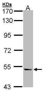 ICAM-1 Antibody in Western Blot (WB)