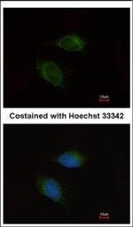 MMP9 Polyclonal Antibody