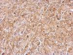 Maspin Polyclonal Antibody