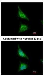 Aladin Polyclonal Antibody