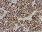 ACADL Polyclonal Antibody