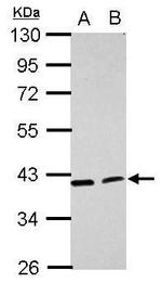 ACADL Antibody in Western Blot (WB)