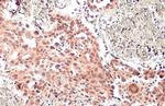 MDM2 Antibody in Immunohistochemistry (Paraffin) (IHC (P))
