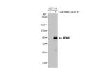 MDM2 Antibody in Western Blot (WB)