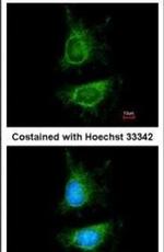 MDM2 Antibody in Immunocytochemistry (ICC/IF)