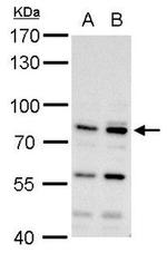 MDM2 Antibody in Western Blot (WB)