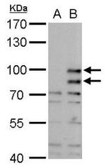 MDM2 Antibody in Western Blot (WB)
