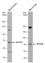 MTHFR Antibody in Western Blot (WB)