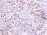 NDRG1 Polyclonal Antibody