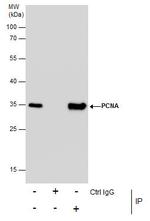 PCNA Antibody in Immunoprecipitation (IP)