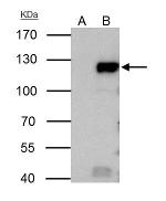 Rb Antibody in Immunoprecipitation (IP)