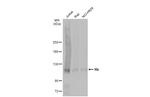 Rb Antibody in Western Blot (WB)