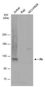 Rb Antibody in Western Blot (WB)