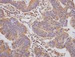 PAI1 Antibody in Immunohistochemistry (Paraffin) (IHC (P))