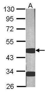 PAI1 Antibody in Western Blot (WB)