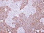 Cytokeratin 15 Polyclonal Antibody