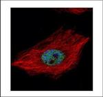 TDP-43 Polyclonal Antibody