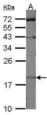 UBE2C Antibody in Western Blot (WB)
