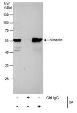 Vimentin Antibody in Immunoprecipitation (IP)