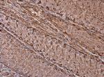 Vimentin Antibody in Immunohistochemistry (Paraffin) (IHC (P))