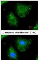 K-Ras Antibody in Immunocytochemistry (ICC/IF)