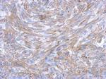 K-Ras Antibody in Immunohistochemistry (Paraffin) (IHC (P))