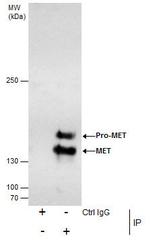 c-Met Antibody in Immunoprecipitation (IP)