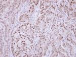 MDM2 Antibody in Immunohistochemistry (Paraffin) (IHC (P))