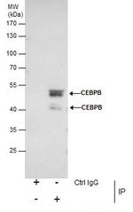 C/EBP beta Antibody in Immunoprecipitation (IP)