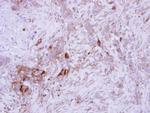 PDGF-B Antibody in Immunohistochemistry (Paraffin) (IHC (P))