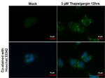 SQSTM1 Antibody in Immunocytochemistry (ICC/IF)
