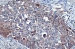 SQSTM1 Antibody in Immunohistochemistry (Paraffin) (IHC (P))