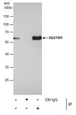 SQSTM1 Antibody in Immunoprecipitation (IP)
