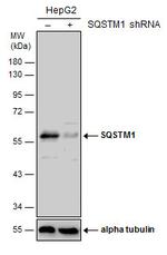 SQSTM1 Antibody in Western Blot (WB)