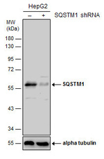 SQSTM1 Antibody in Western Blot (WB)