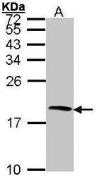 Cystatin S Antibody in Western Blot (WB)