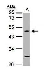 Cytokeratin 20 Antibody in Western Blot (WB)