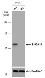 S100A10 Antibody in Western Blot (WB)