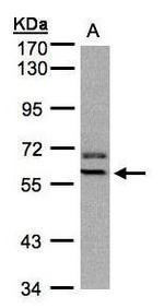 PAX7 Antibody in Western Blot (WB)