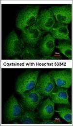 MMP12 Polyclonal Antibody
